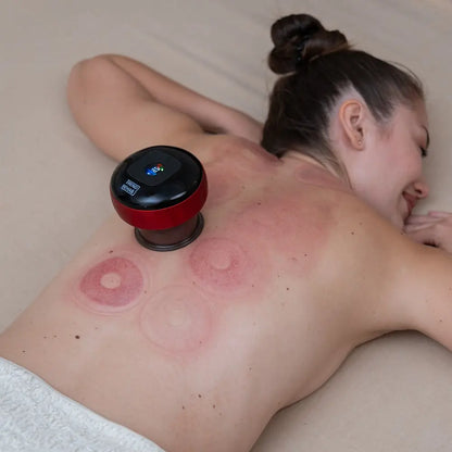 Elektrisk cupping 12 nivåer