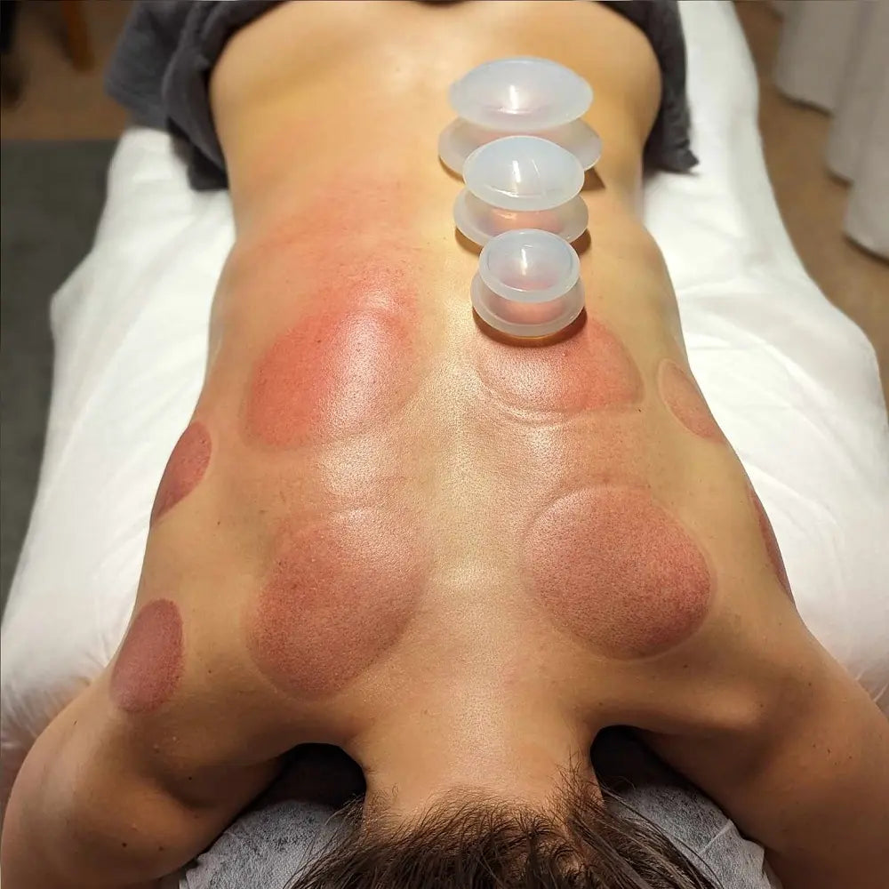 CuppingSet – effektiv och avslappnande massage