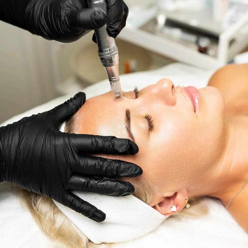 Microneedling Pen